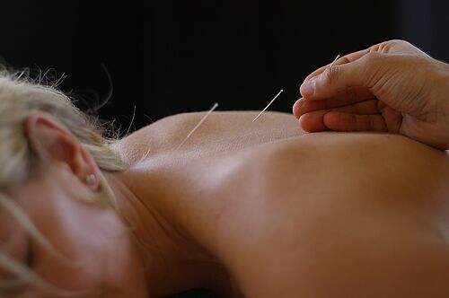 Akupunktur setzt an der körperlichen Seite der Depressionen an