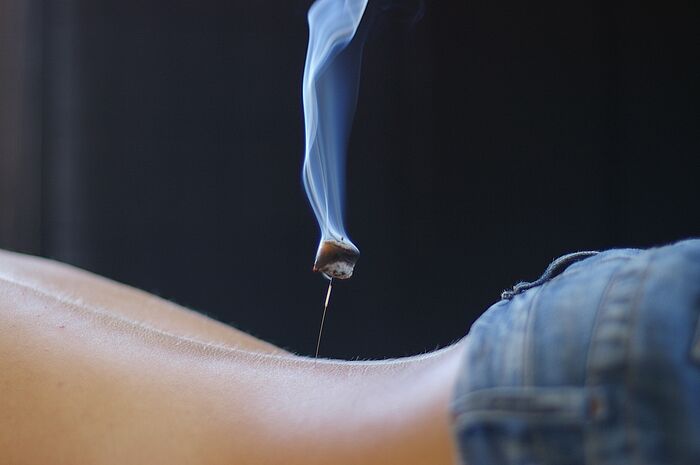 Moxibustion ist eine besondere Form der Akupunktur